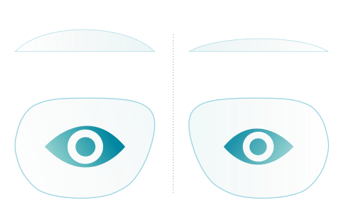 Geringere Eigenvergößerung der Augen durch neues Gleitsichtglas